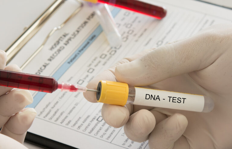 What You Should Know Before Taking A Home Dna Test Tgdaily 