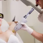 doctor-performing-laser-hair-removal-patient-skin