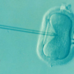 Ivf Fertility Infertility Microfertilization Ovum